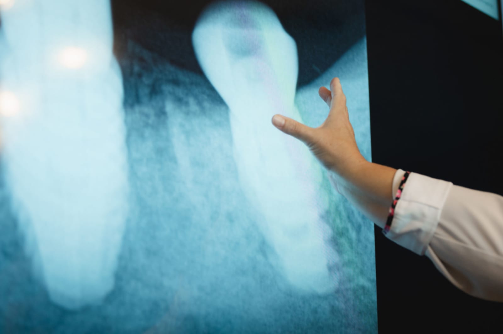 Dentist reviewing X-ray with patient in clinical setting