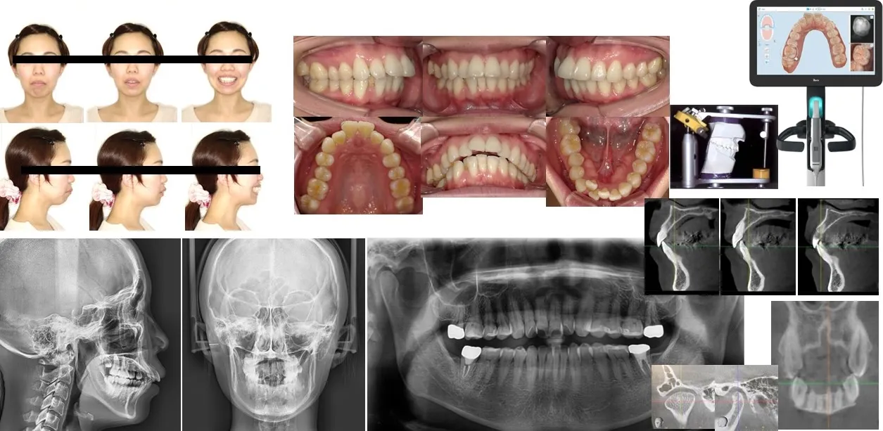 ケースセレクションに関するご相談