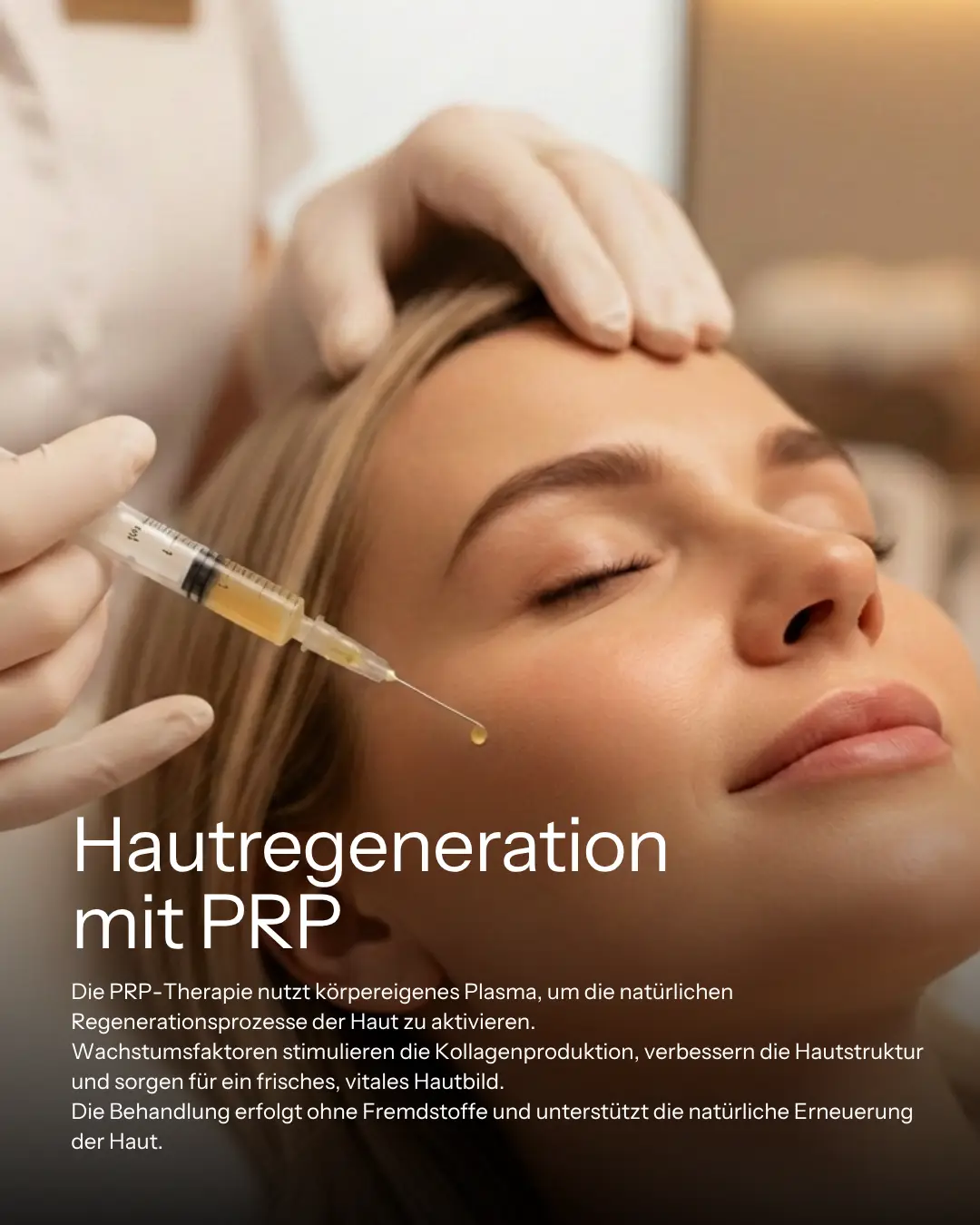 Instagram Post Behandlung Hyaluron Frau