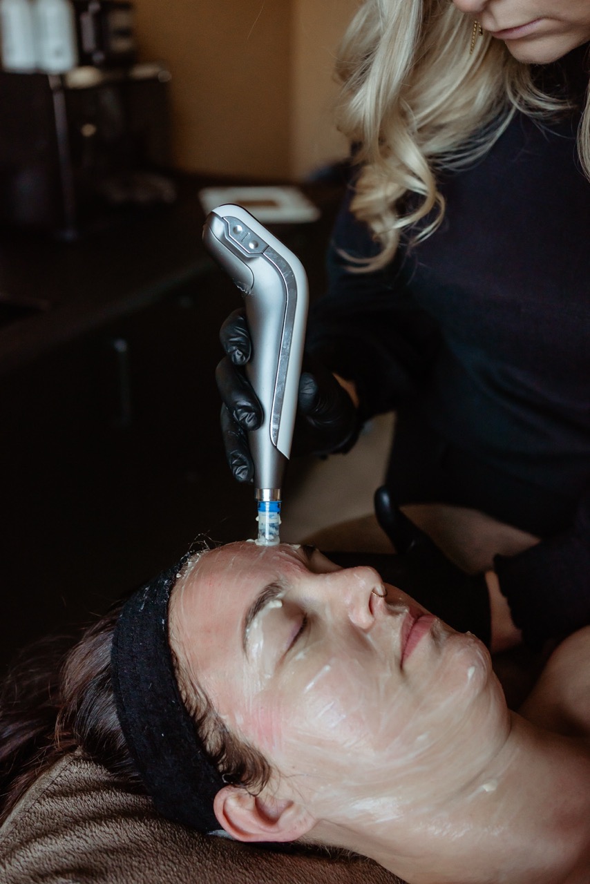 huidverjonging in Rietmolen