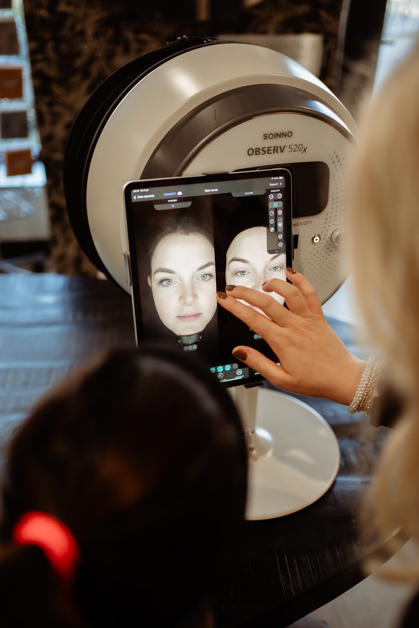 roodheid verminderen rietmolen