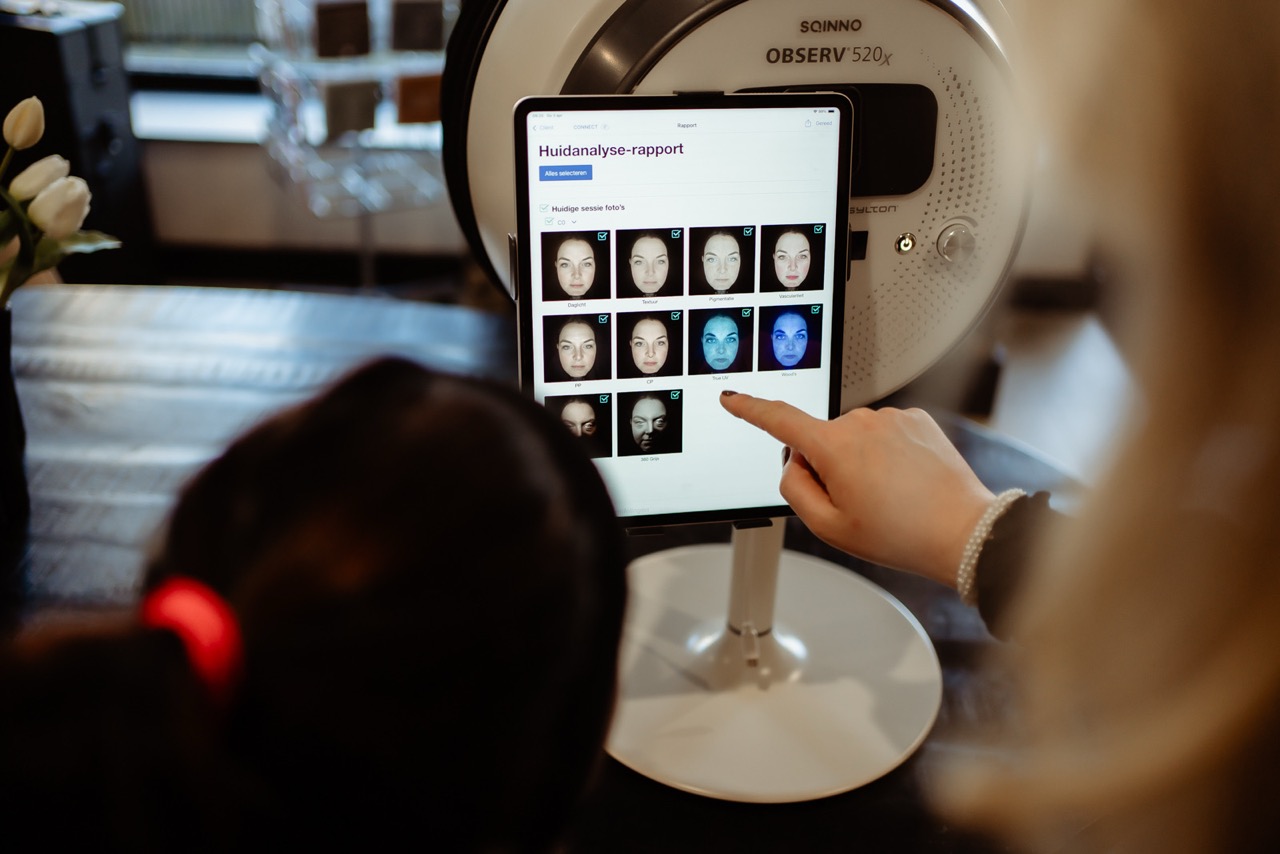 donkere verkleuringen verminderen