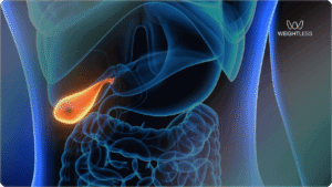 Can You Take Mounjaro With Gallstones