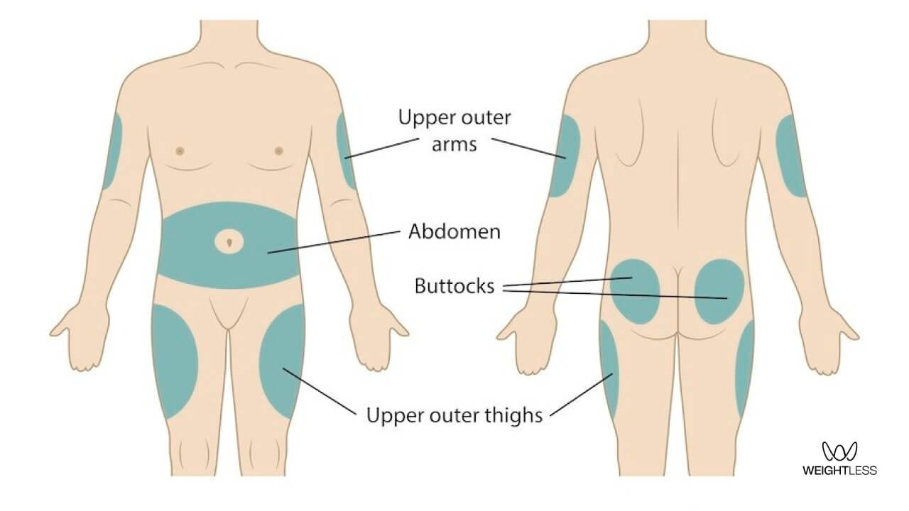 where and how to inject mounjaro