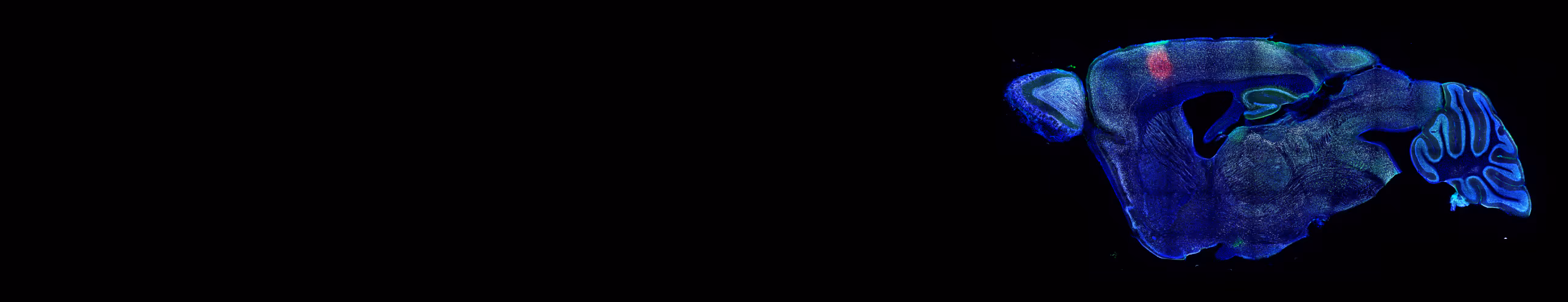 Fluorescence microscopy image of sagittal mouse brain section with blue labeling throughout and red and green highlighted region