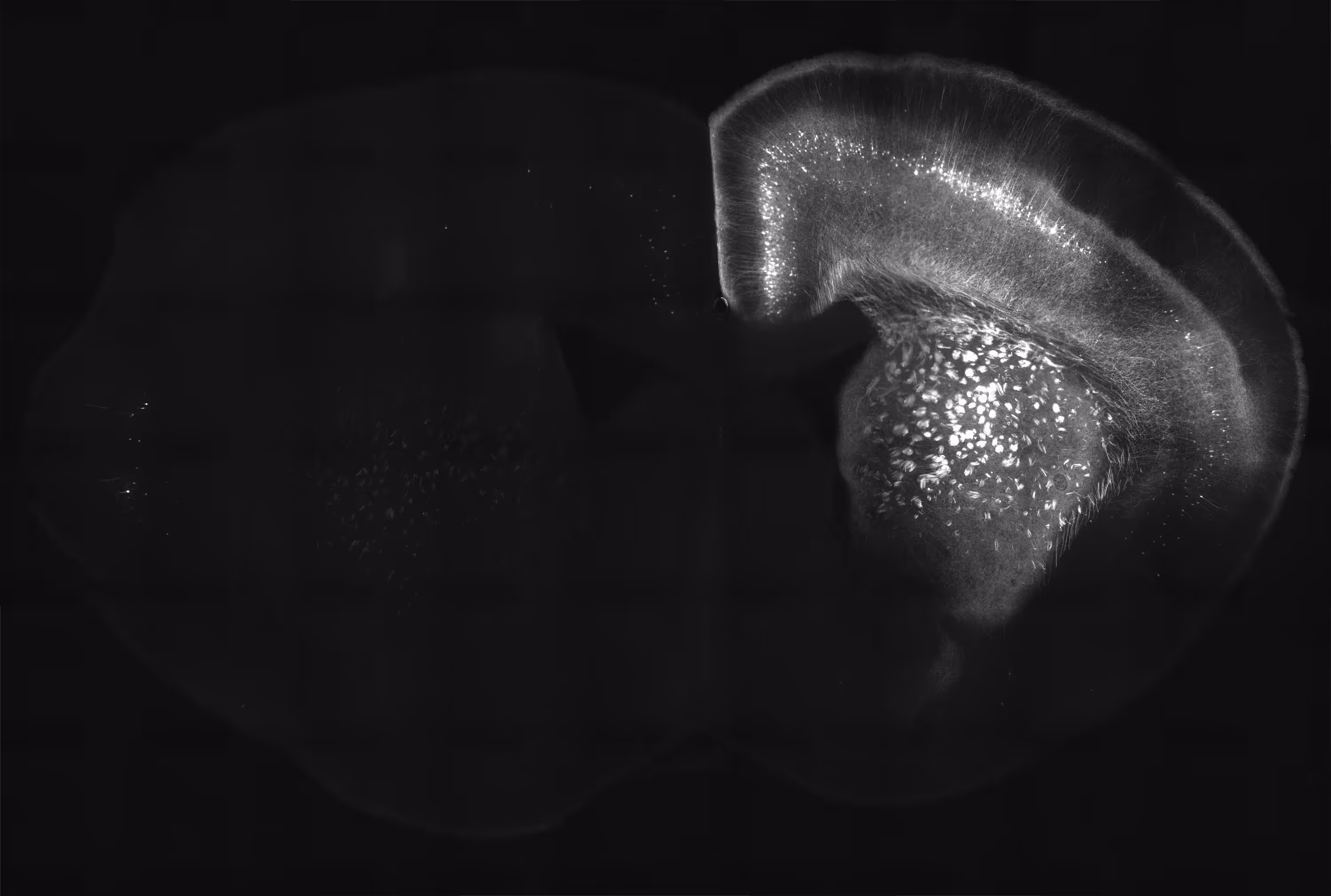 Grayscale fluorescence microscopy image showing brain tissue cross-section with bright cellular labeling and fiber tracts.
