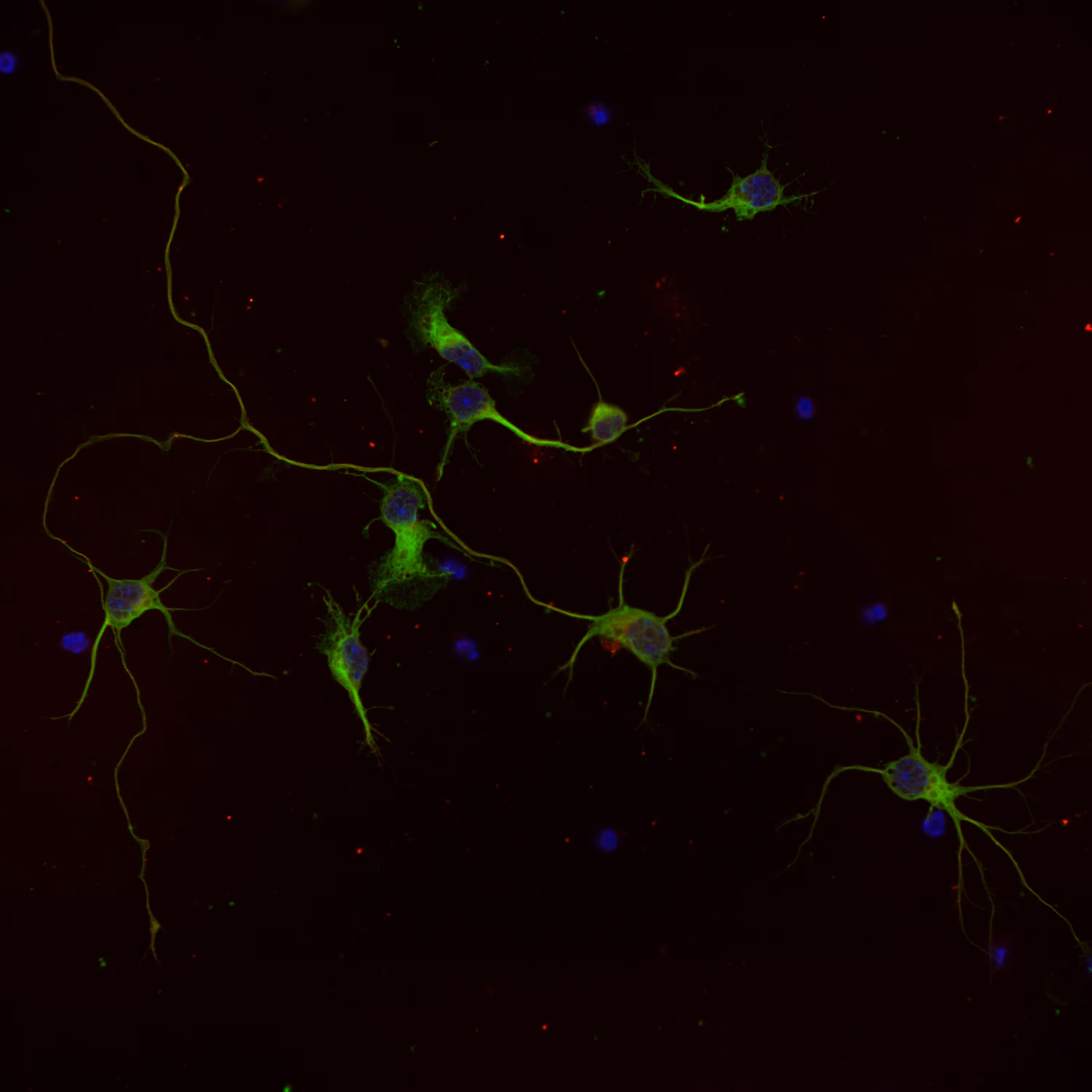 Fluorescence microscopy image of individual neurons in green with blue nuclei and red markers scattered throughout