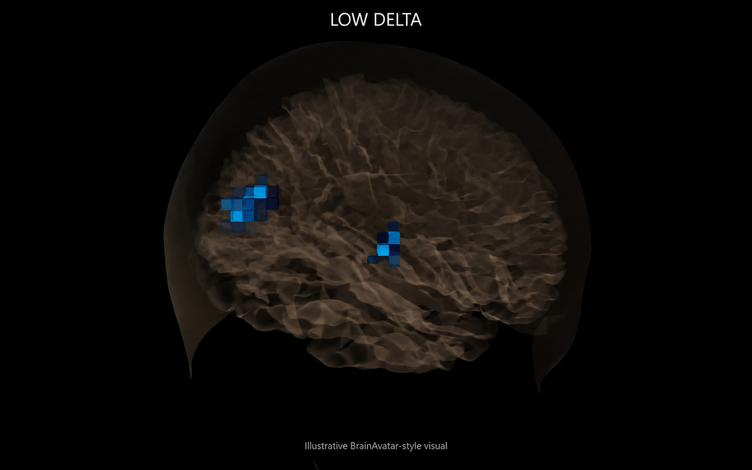 Brain map showing only small areas of low delta activity