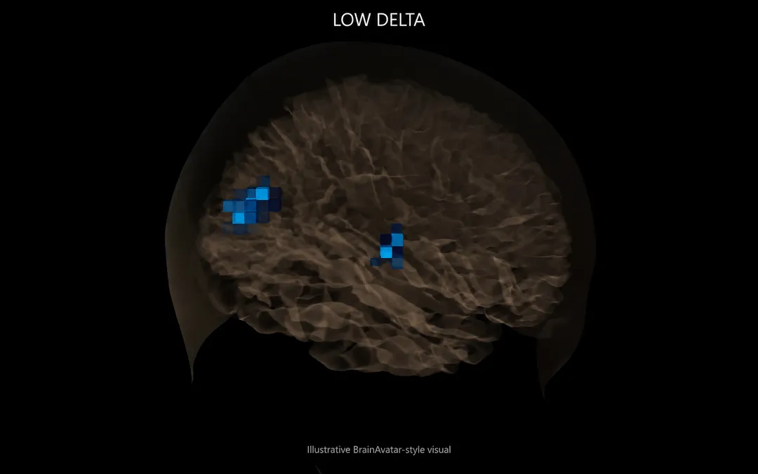 Brain map showing only small areas of low delta activity