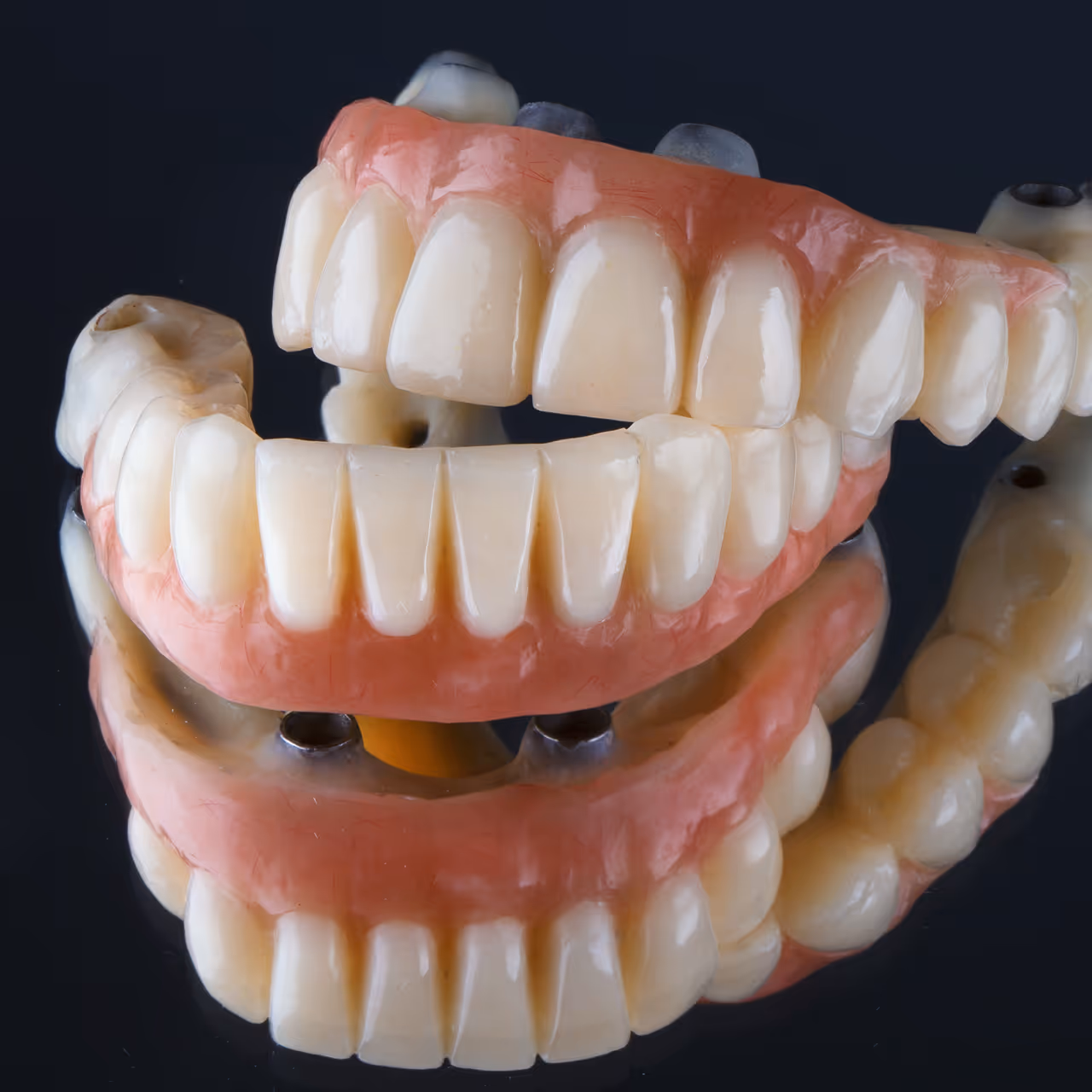Zahnimplantate Wien: Detaillierte 3D-Modell-Nahaufnahme von Zahnprothesen