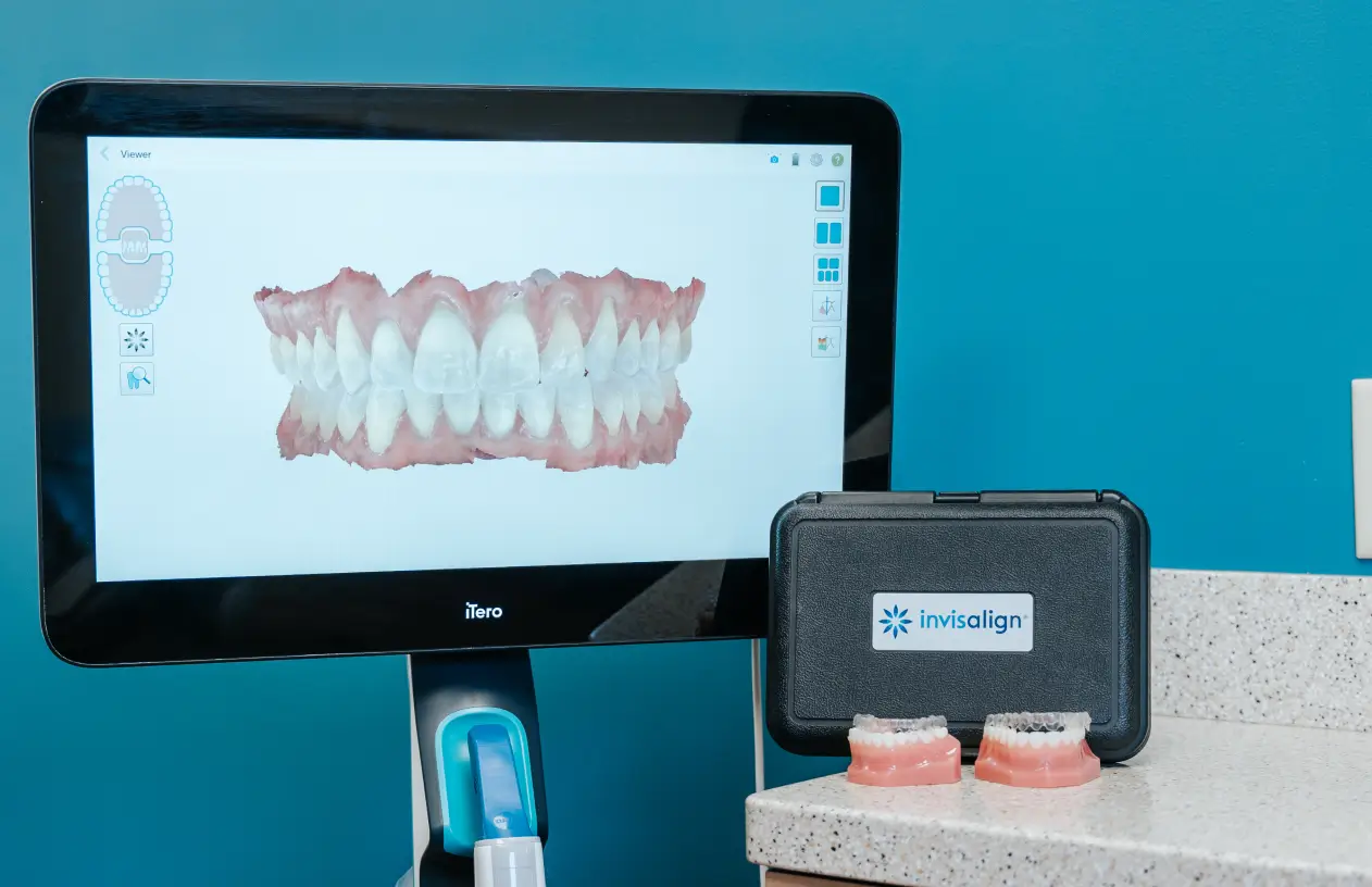 A dental scan of teeth displayed on a monitor, with Invisalign case and dental molds on the counter.