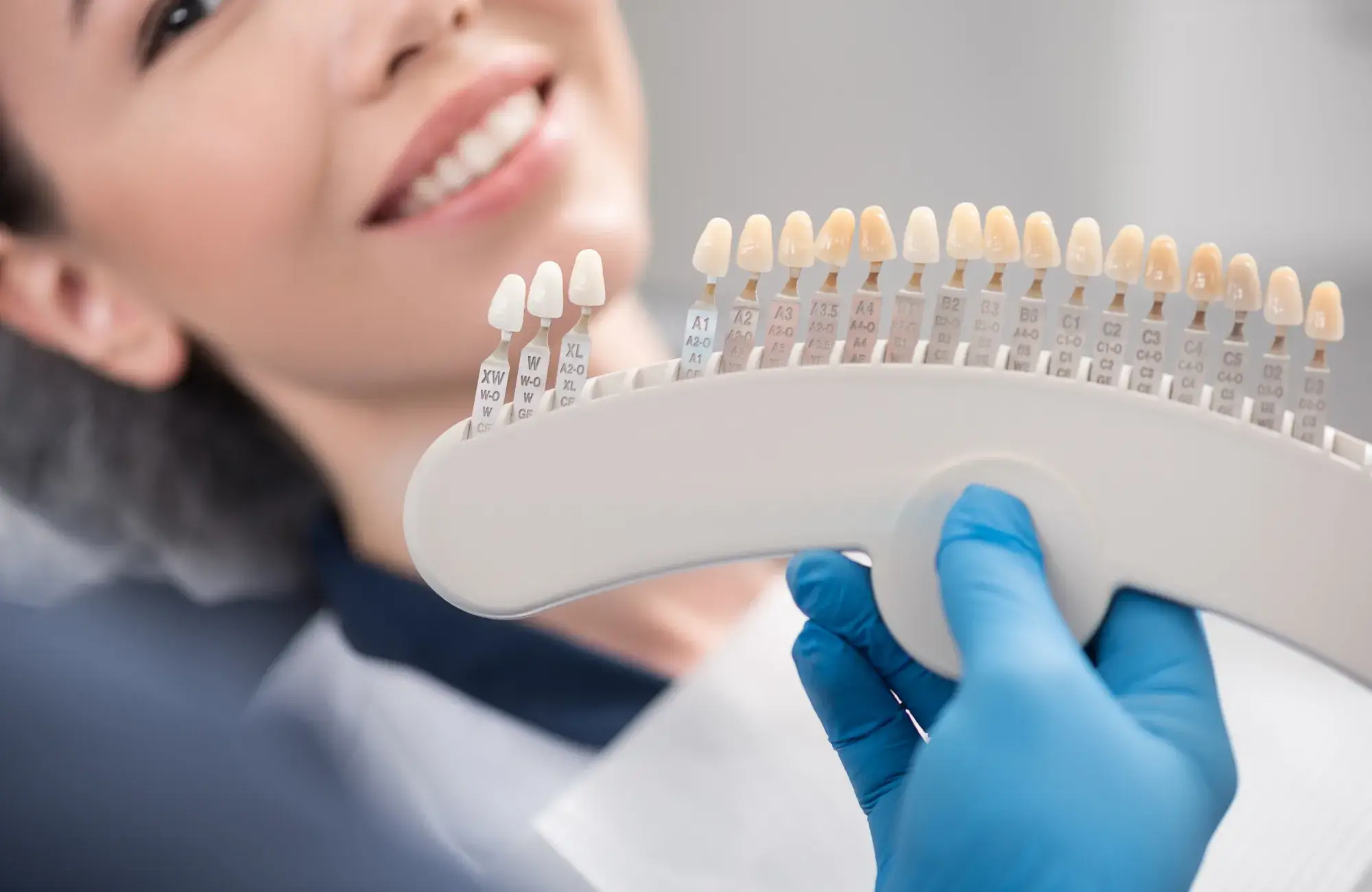 Dentist wearing blue gloves holding a dental shade guide near a smiling patient's mouth to match tooth color.
