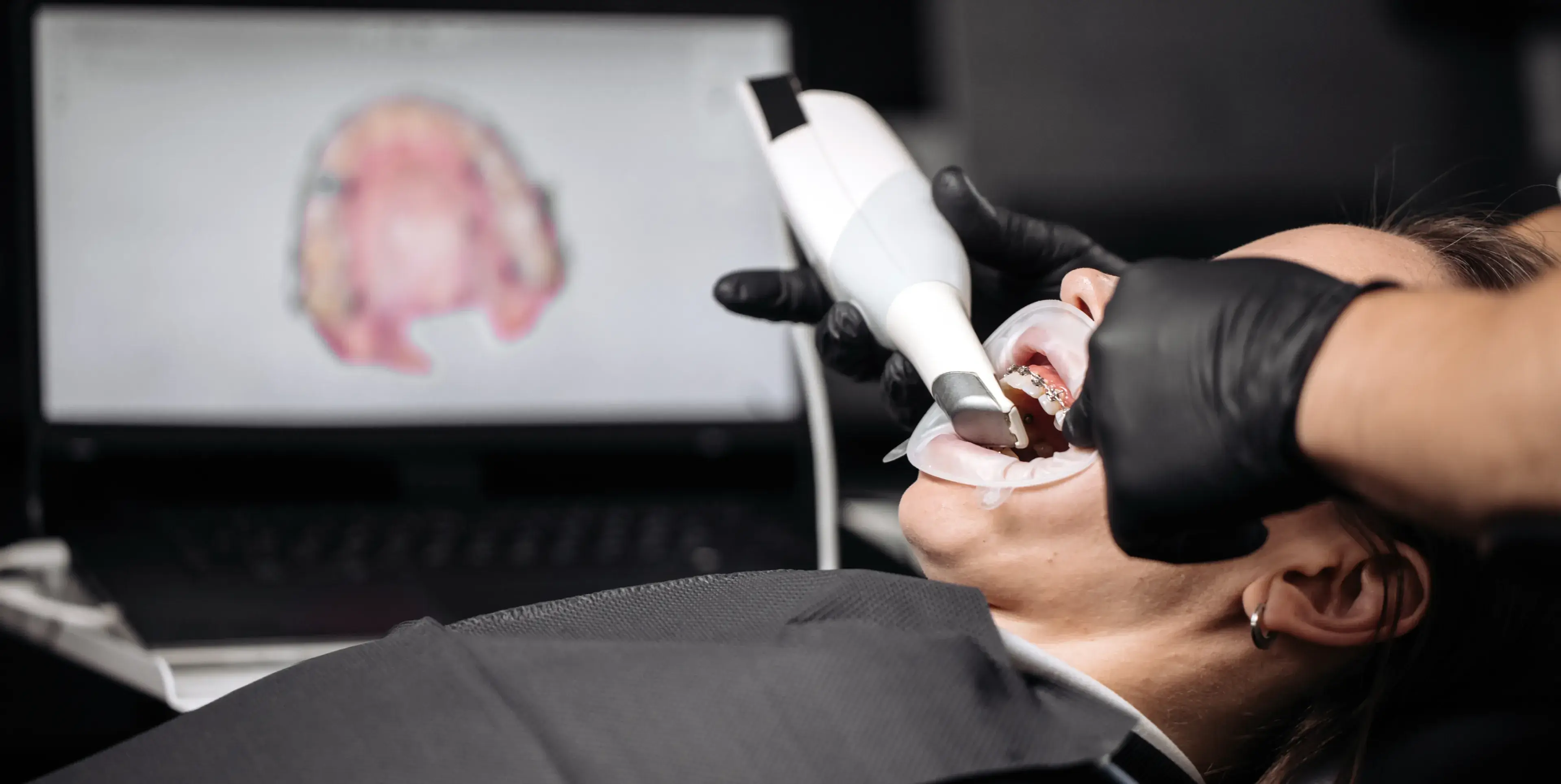 Dental professional using an intraoral scanner to capture a 3D image of a patient's teeth with braces.