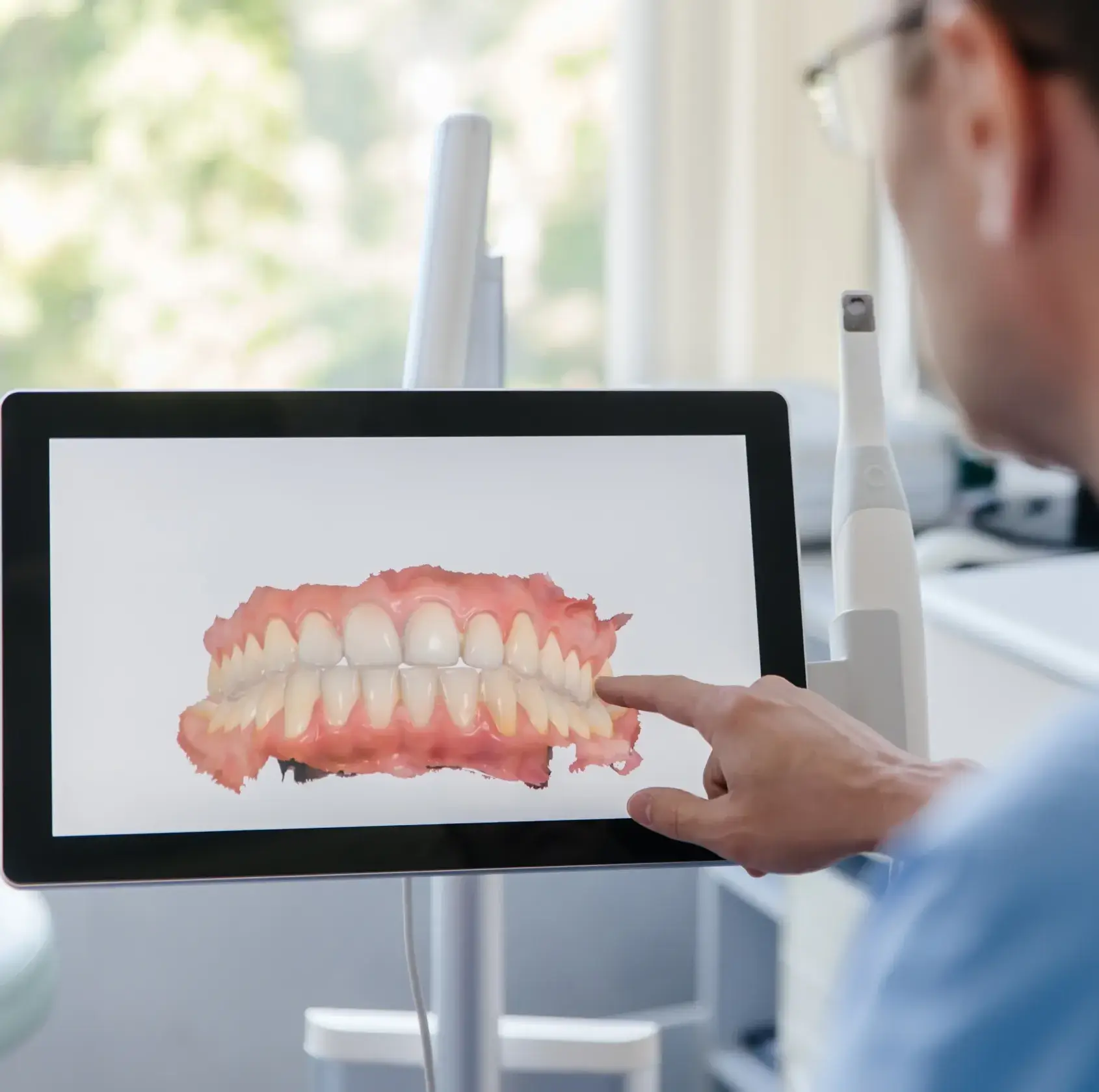 Dentist pointing at a 3D digital dental model of teeth and gums on a screen.