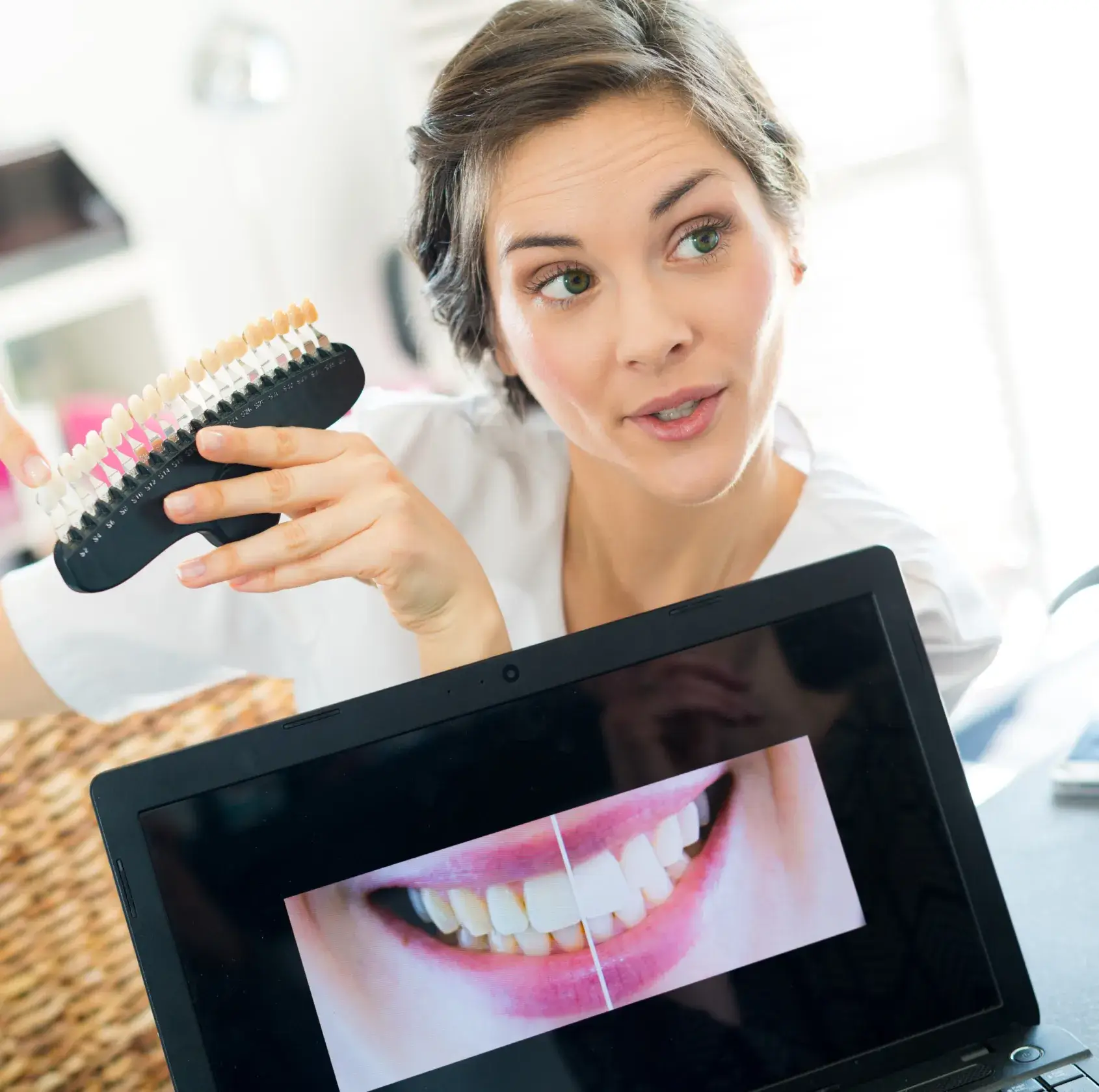 Woman holds a dental shade guide while showing a laptop screen with a close-up of teeth before and after whitening.