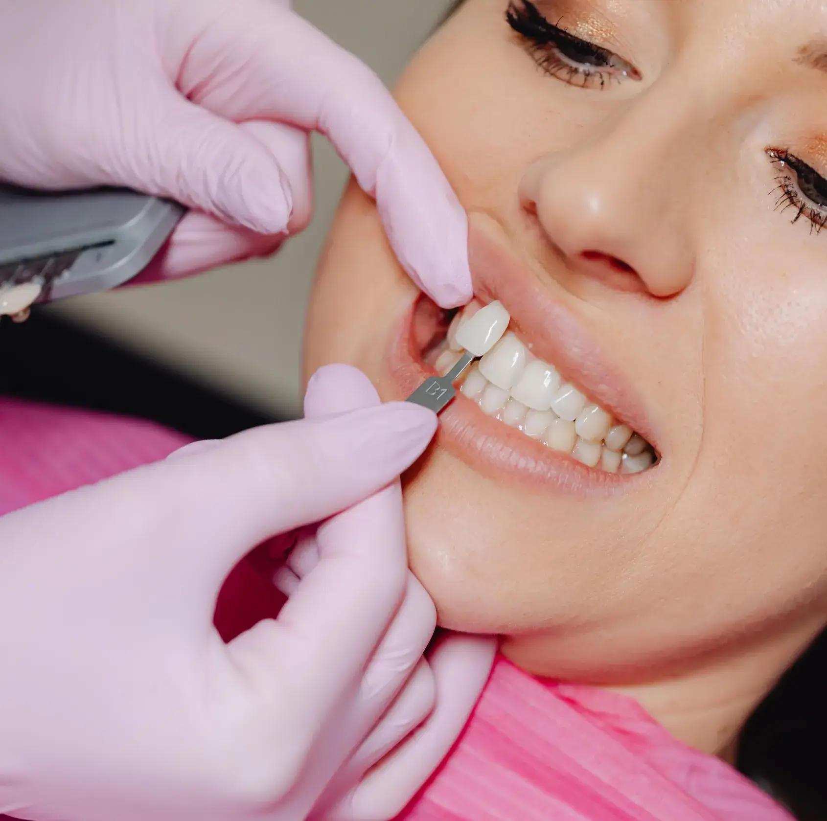 Dentist wearing pink gloves holding a shade guide to match the color of a patient's upper front teeth.