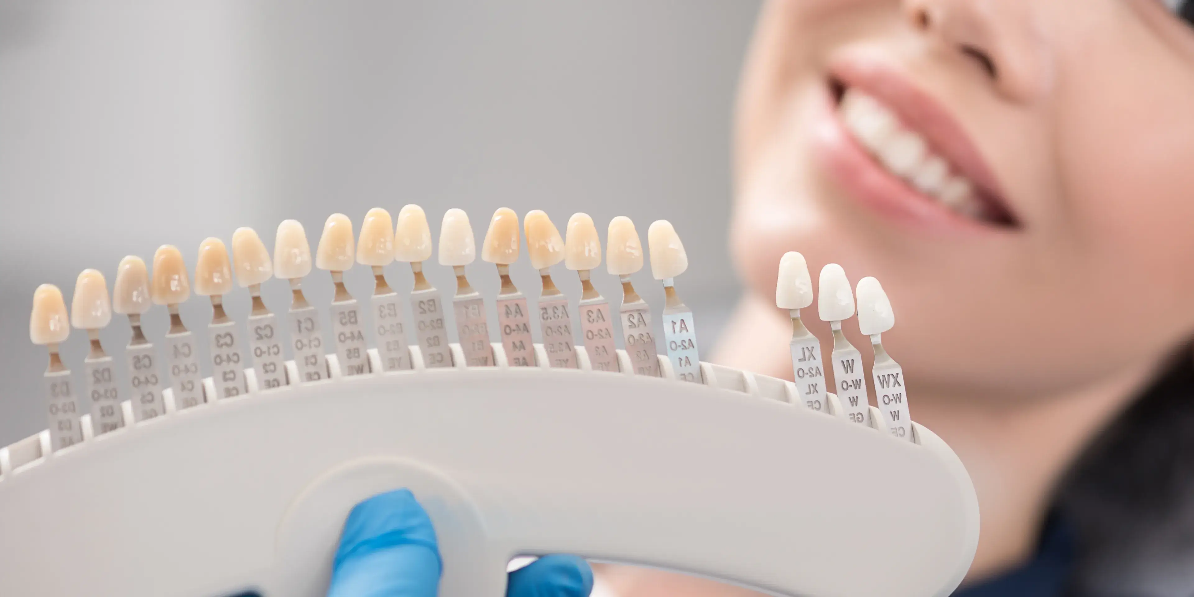 Close-up of a dental shade guide held by a gloved hand with a smiling woman in the background.