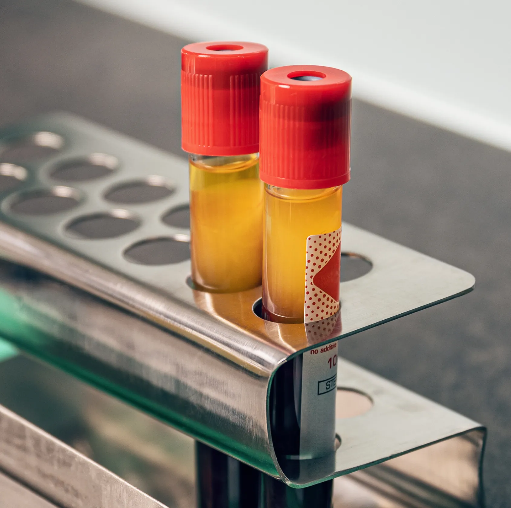Two blood collection tubes with red caps containing yellow plasma, placed in a stainless steel test tube rack.