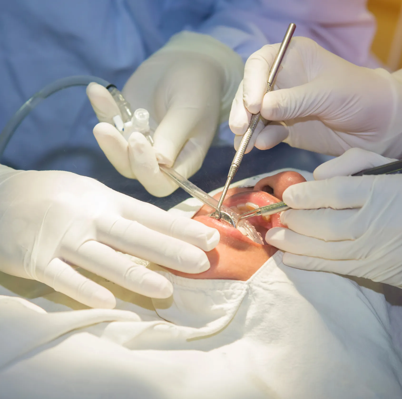 Dentist wearing gloves performing oral surgery on a patient's open mouth using dental instruments.