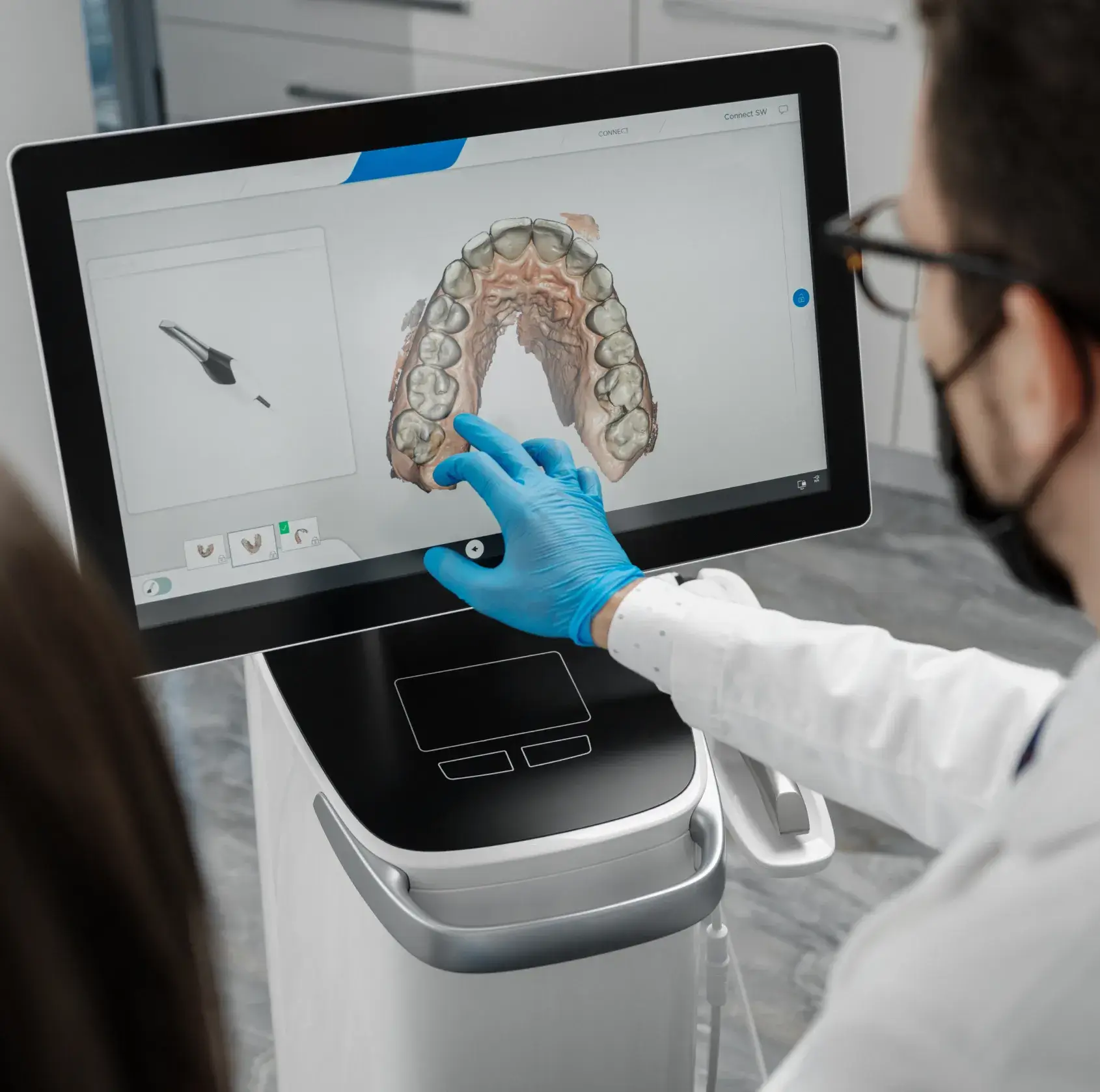 Dentist wearing blue gloves interacting with a 3D digital model of upper teeth on a touchscreen dental scanner.