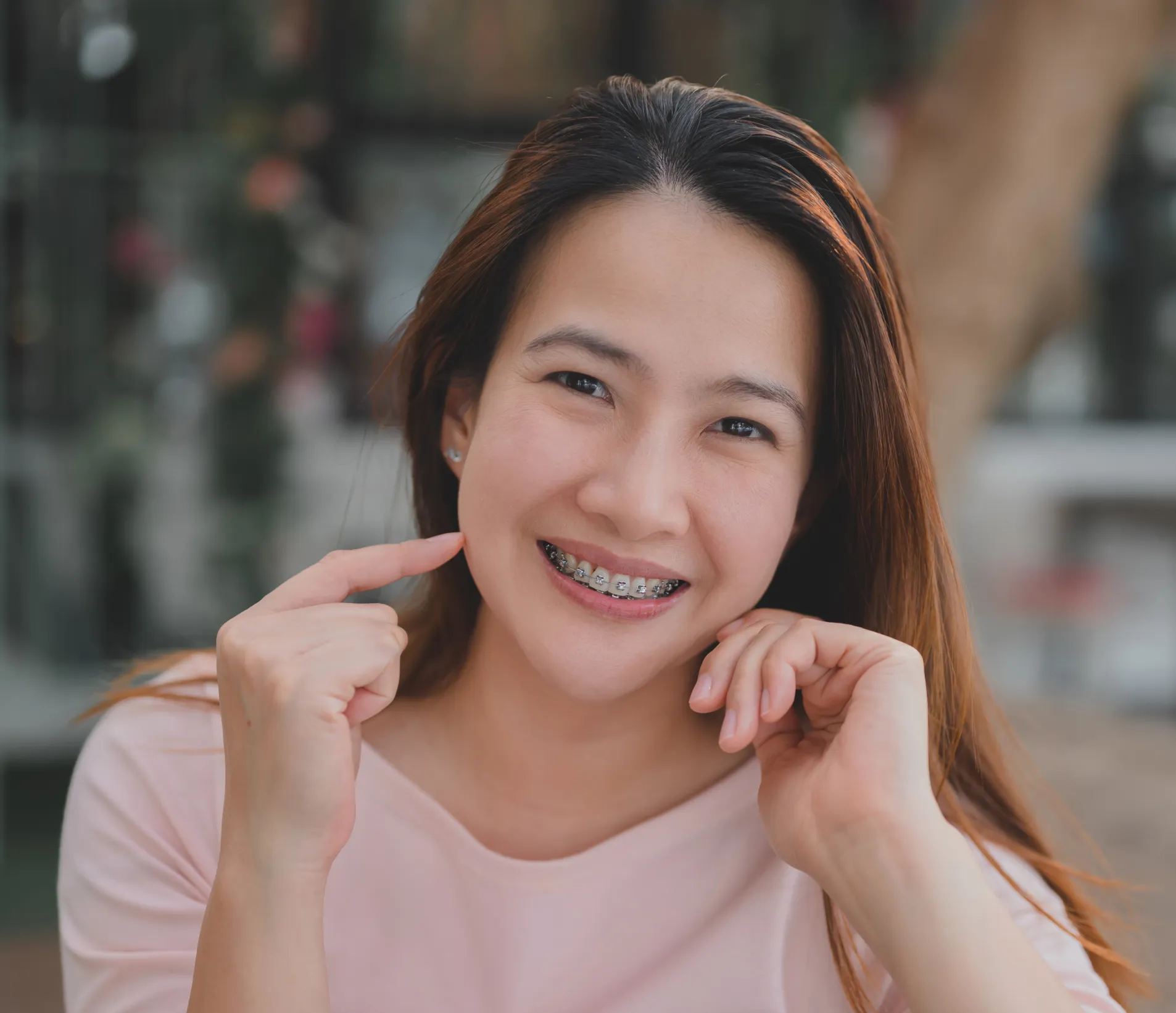 Orthodontics in Southern California