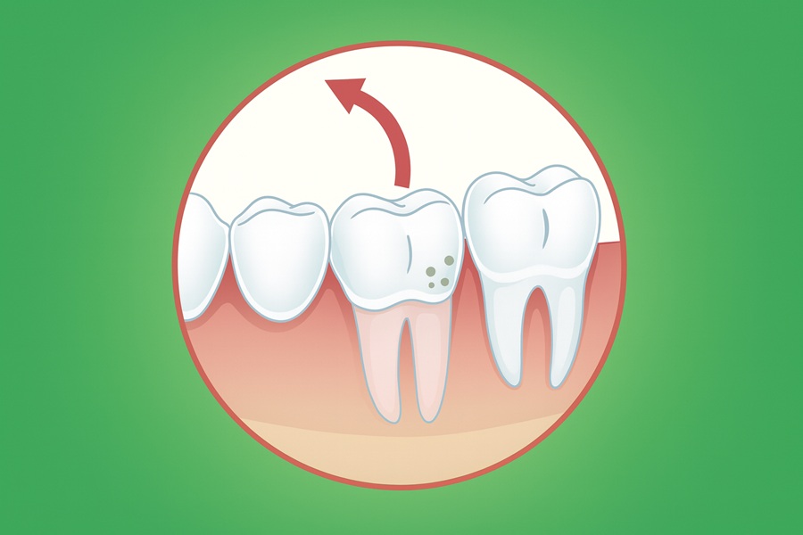 24 Signs You May Need Tooth Extraction: When Removal Becomes Essential