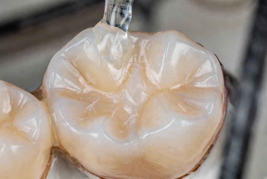 Enamel Regeneration Gels: Hype or Real Breakthrough?