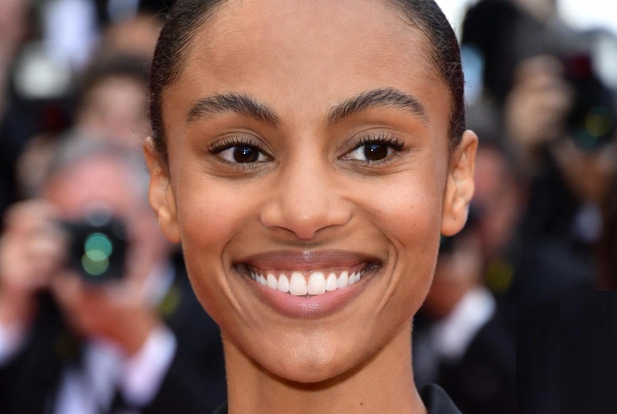 Hollywood Smile 2.0: Top Cosmetic Dentistry Trends Taking Over America in 2026