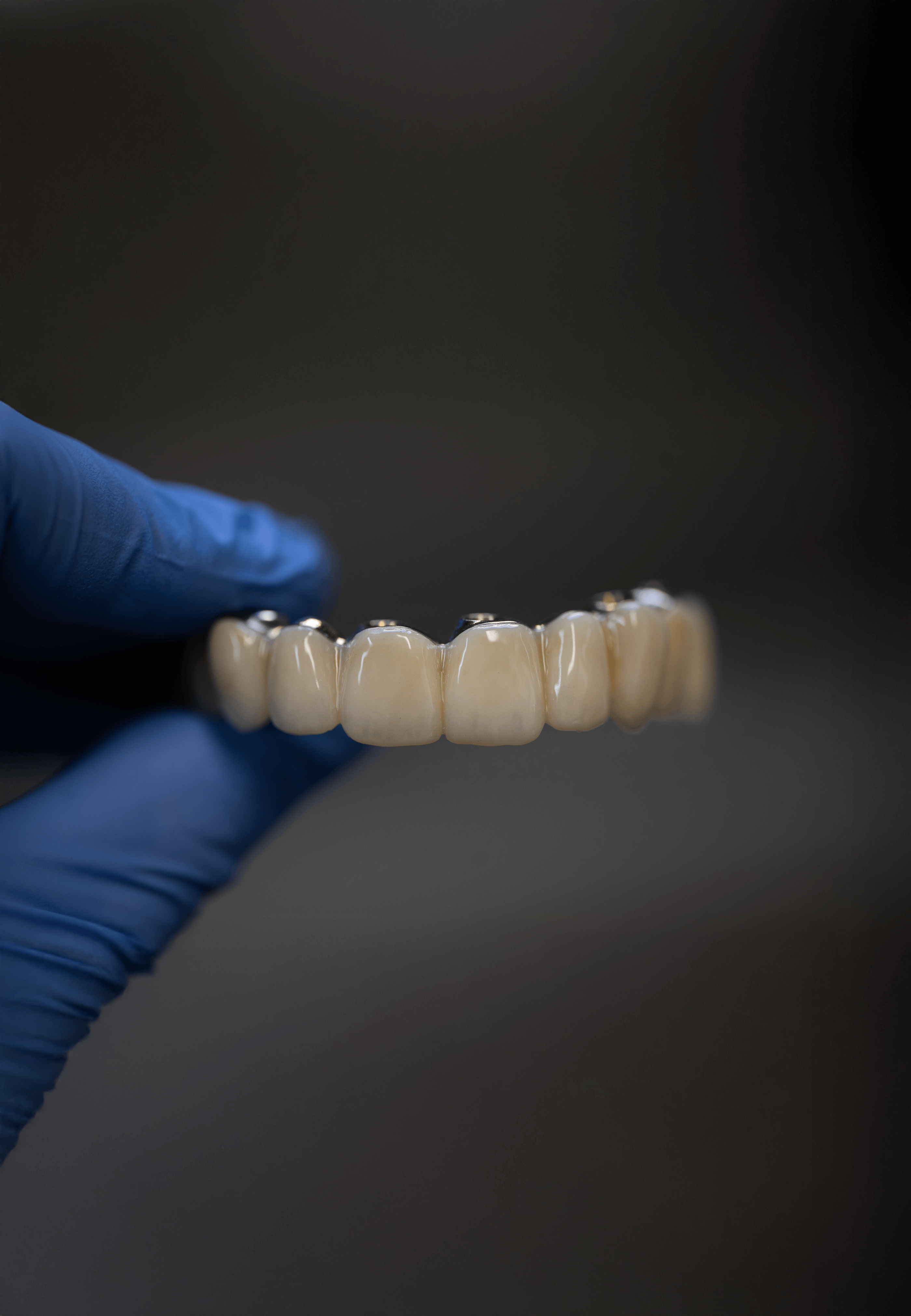 Blue gloved hand holding dentures at Evolution Dentures in Regina.