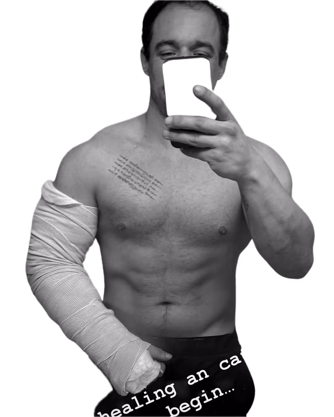 Shirtless man taking a selfie with a wrapped and bandaged left arm and a tattoo on his chest.