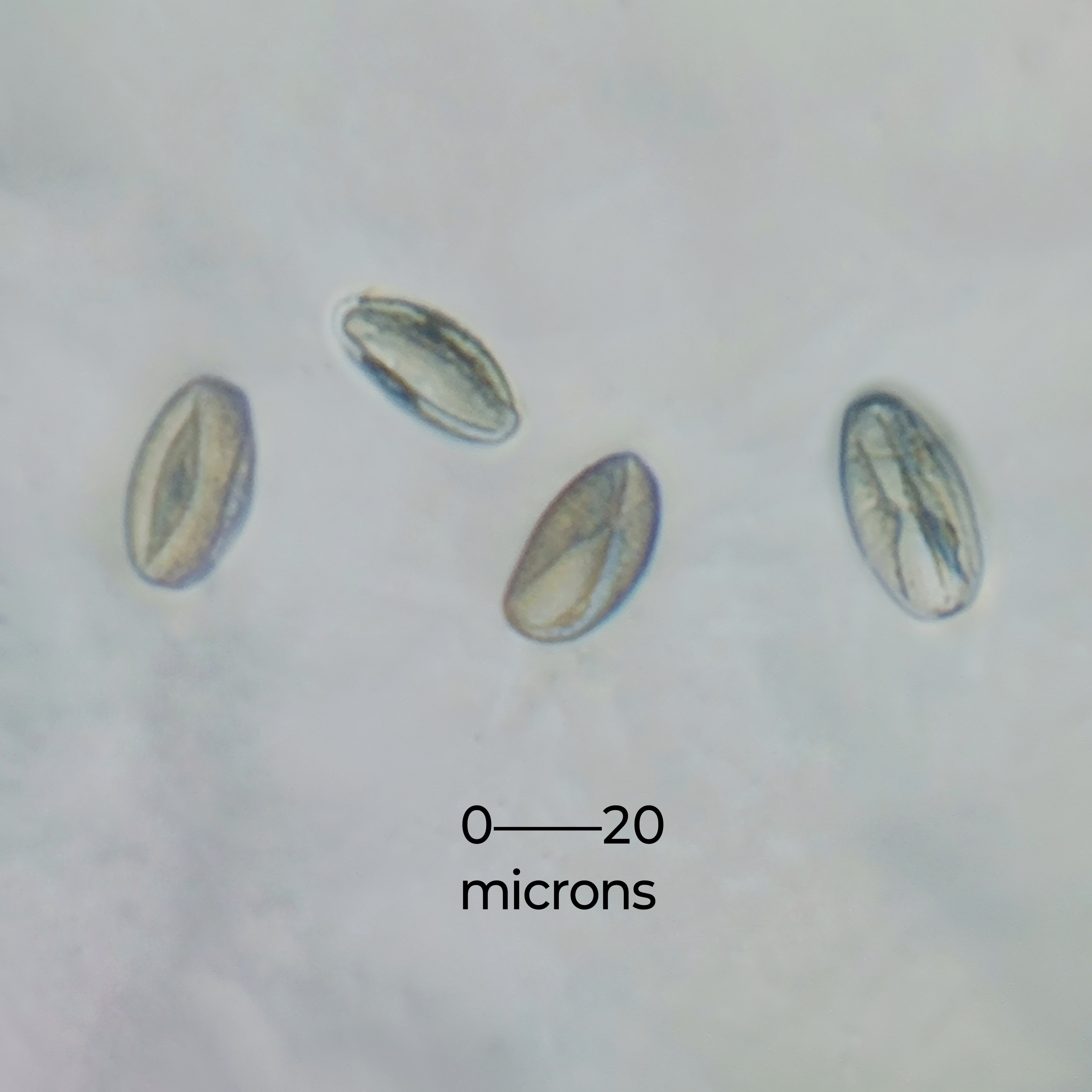 Pollen grains of Cassia fistula
