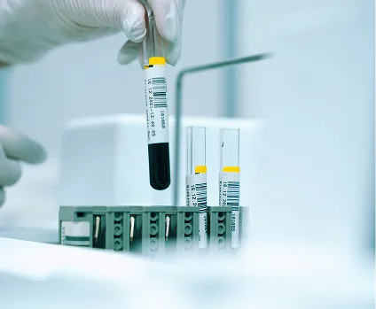 A scientist keeping a test tube inside a container having other test tubes
