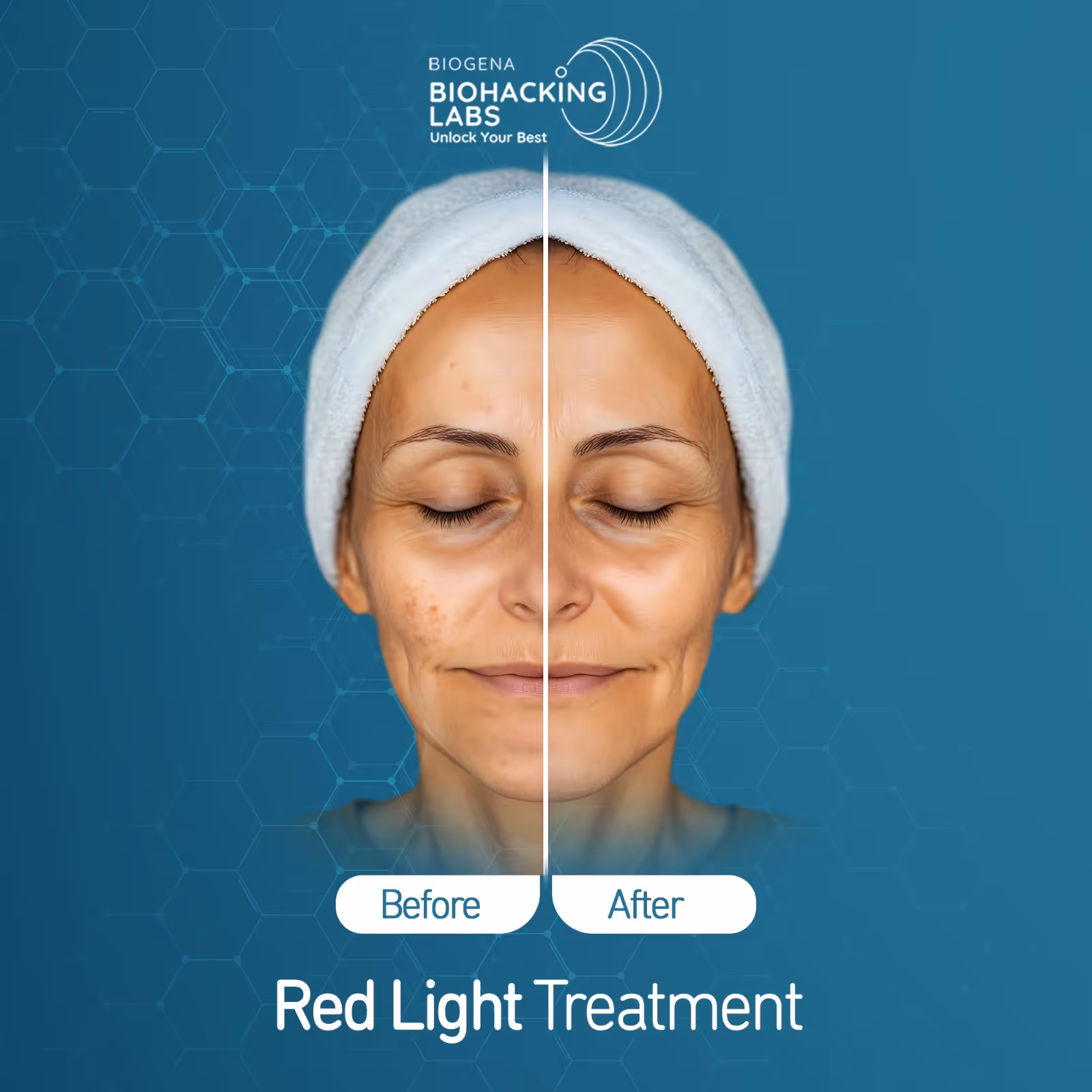 Vorher-Nachher-Bild einer Frau mit sichtbarer Hautverbesserung nach Rotlichttherapie.