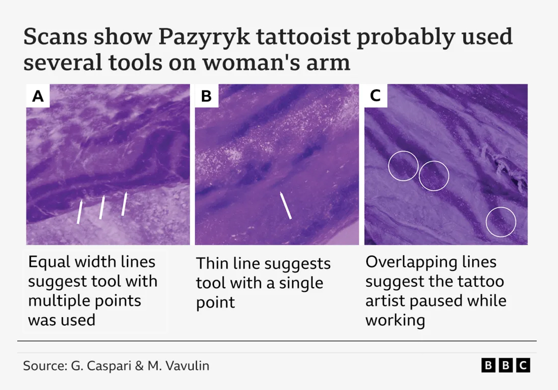High-resolution scans and images of the woman's skin give insights into the tattoo method