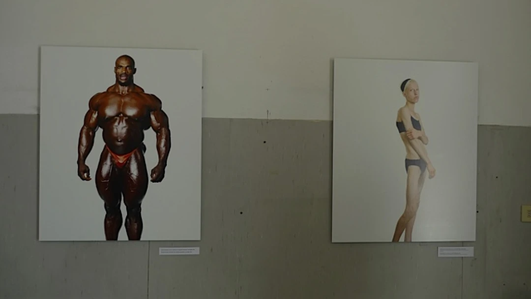 Two large photographic prints hung on a gallery wall: an absurdly muscular bodybuilder in red trunks on the left and a skeletal young woman in underwear on the right, from Zed Nelson's Love Me project.