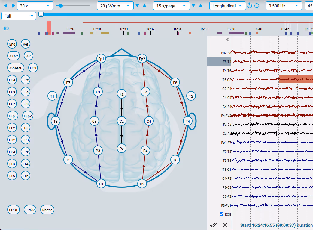 EEG montage editor screen showing a brain diagram with labeled electrode positions and arrows, alongside EEG waveform recordings with time stamps at the top.