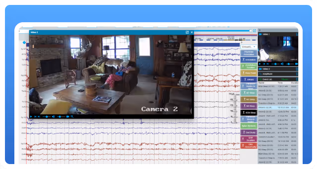 Screen showing EEG remote monitoring interface with a video playback of a living room labeled Camera 2.