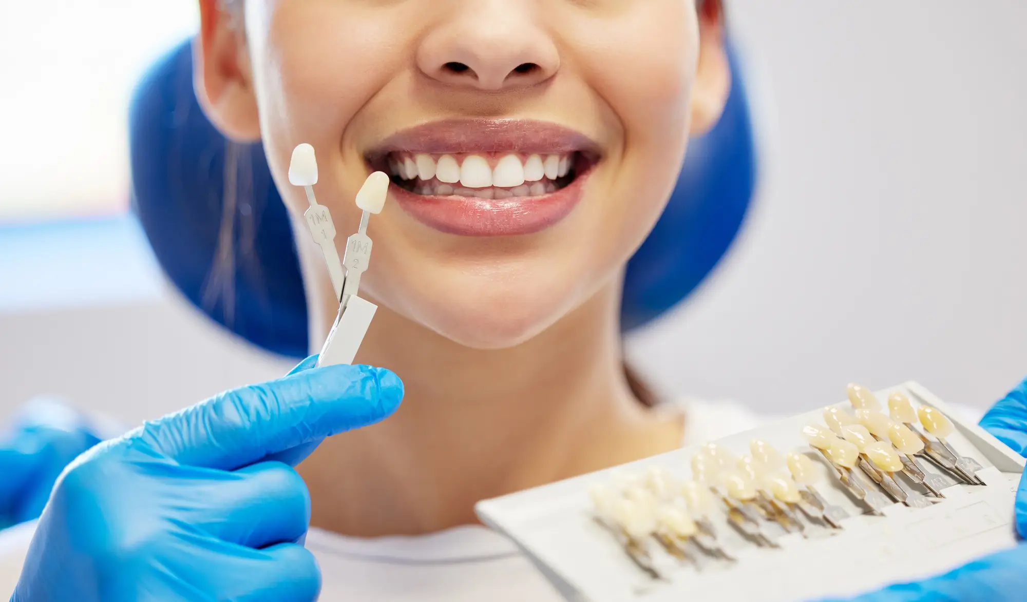 Veneer Treatment by Cosmetic Dentist in Westchester County, NY