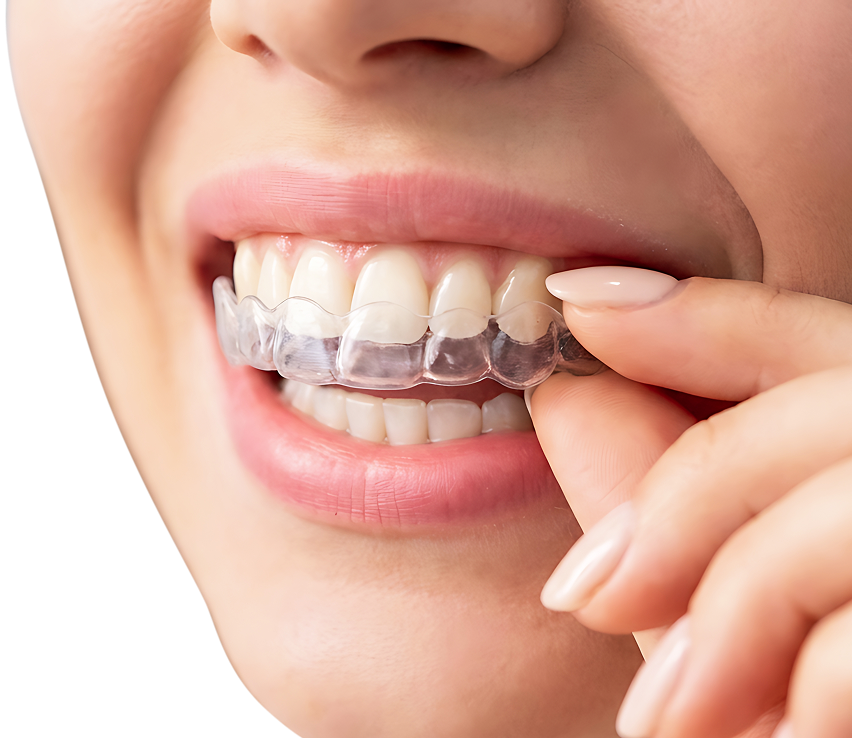 Paciente sonriendo con brackets de zafiro