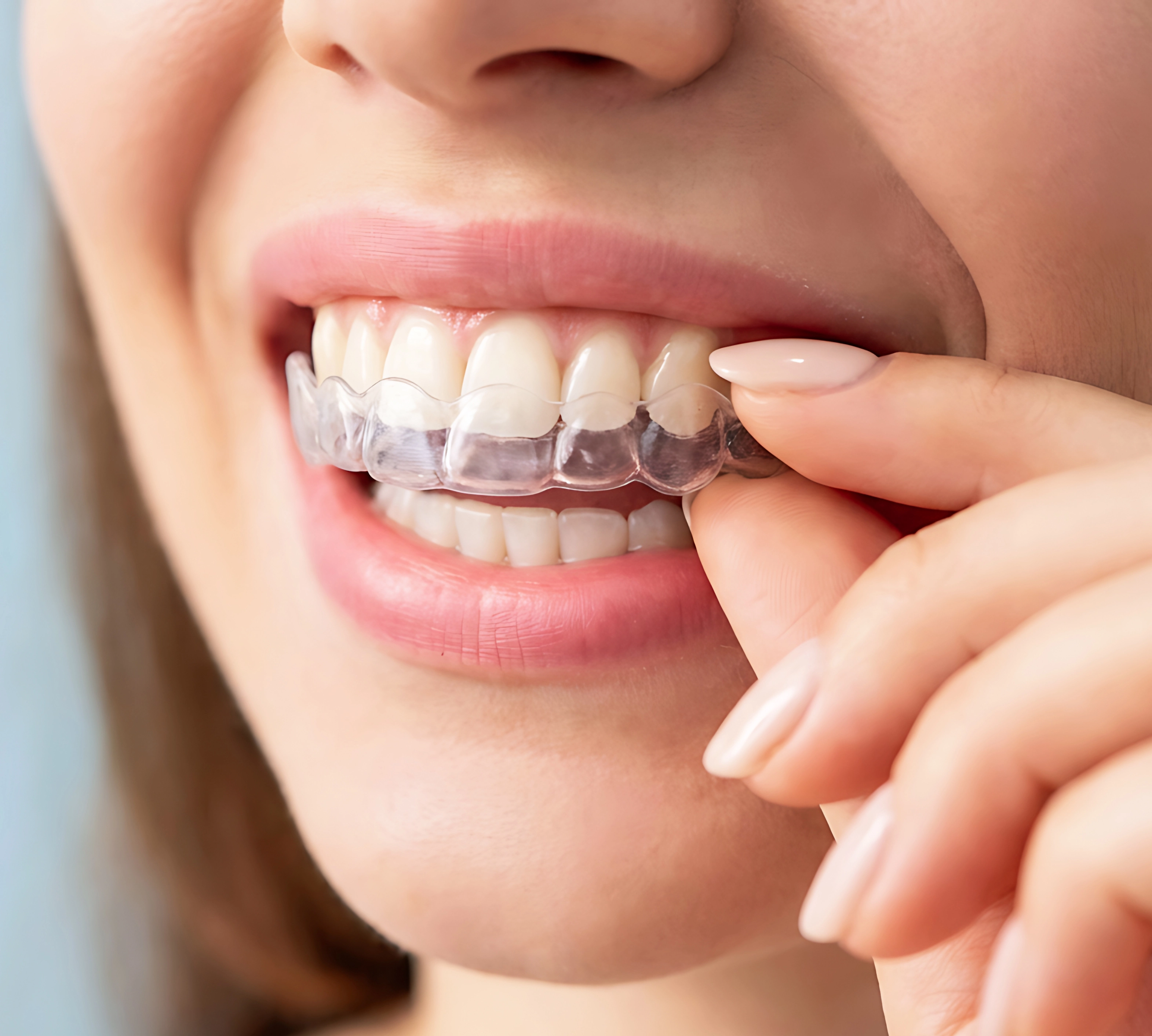 Tarjeta de servicios de MX Brackets