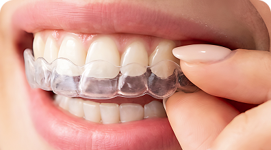 Bracket para corrección dental