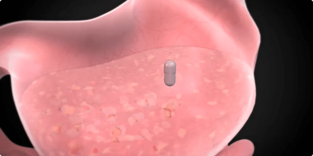 epitomee capsule video thumbnail