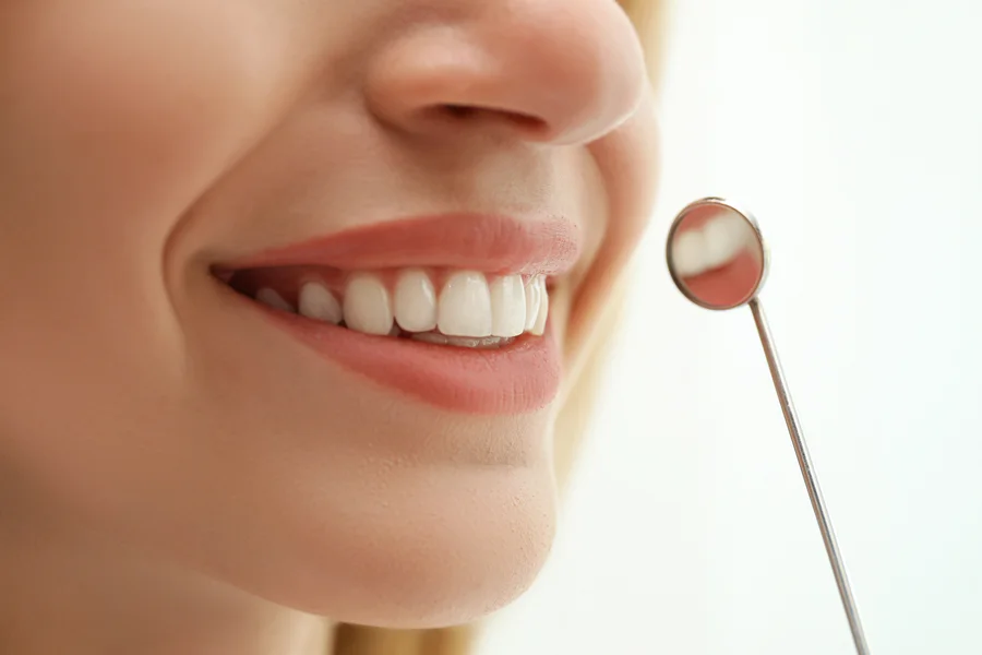 A composite bonding repair and a porcelain veneer can look nearly identical the day they're placed, but a pooled analysis of clinical trials found bonding holding up at about 88% after two to eight years. A separate review of porcelain veneers put survival closer to 93% at ten years. That gap does not mean one option is simply better. It means the right choice depends on what a patient actually needs from the treatment, which is exactly the kind of judgment call worth walking through with a cosmetic dentist in NJ before committing to either one. What Actually Separates the Two Materials Bonding is a resin material applied directly to the tooth, shaped by hand, and hardened with a curing light in a single visit. Veneers are thin porcelain shells fabricated outside the mouth, typically over two appointments, then bonded to the front of the prepared tooth. That difference in fabrication explains most of what follows: bonding can be adjusted or repaired chairside since the material is still soft before curing, while a veneer that chips or de-bonds usually needs to be remade entirely. The Durability Gap, By the Numbers The research on both materials is more specific than most marketing pages suggest. A systematic review of randomized trials found composite bonding survived at roughly 88% across follow-up periods ranging from two to eight years, with surface roughness and minor discoloration as the most common complications rather than outright failure. A separate meta-analysis of porcelain veneers reported a survival rate of nearly 93% at the 10-year mark, with most failures involving de-bonding or fracture rather than gradual wear. Neither number tells the whole story on its own. Bonding's lower survival rate reflects a material that ages visibly rather than failing catastrophically, and many of those "failures" are actually just a polish or minor touch-up away from looking new again. This is precisely the kind of nuance a cosmetic dentist in NJ can walk a patient through, since a number on a research page does not account for an individual's bite, habits, or how a tooth was prepared. A quick way to think about which option tends to fit a given situation: A single chipped or slightly discolored tooth often responds well to bonding Multiple teeth needing a uniform, dramatic color or shape change lean toward veneers A tighter budget or a "let's try it first" mindset favors bonding's lower upfront cost A long-term investment with fewer touch-up maintenance points toward porcelain Enamel that is already thin or compromised may rule out traditional veneer preparation What You're Actually Paying For The price difference between bonding and veneers is not just about material cost. Veneers require removing a thin layer of enamel to make room for the porcelain shell, which is a permanent change to the tooth that cannot be undone. Bonding does not require that step, which is part of why it is often described as more conservative, even though it is not entirely maintenance-free either. This is also where the case for consulting a cosmetic dentist in NJ before making a choice becomes more than a formality. A dentist examining the tooth in person can flag enamel thickness, bite forces, or staining depth that changes, which option actually makes sense, details that are impossible to judge from a photo or a general description online. Financing options are also available for patients weighing the cost difference between the two treatments. How the Decision Gets Made at a Consultation At Dental Arts of Haddonfield, Dr. Heidi Choi and Dr. Shiv walk patients through both options during a cosmetic consultation, looking at the specific tooth or teeth involved rather than defaulting to whichever treatment is more common. Bonding and veneers are sometimes combined with professional teeth whitening as well, since matching the surrounding teeth's shade first can change how many teeth actually need cosmetic work at all. Talk to a Cosmetic Dentist in NJ About Your Options Choosing between veneers and bonding is easier with someone who can actually examine the tooth and explain the trade-offs in plain terms. Dental Arts of Haddonfield offers cosmetic consultations with a cosmetic dentist in NJ who can help you decide which option fits your smile, your budget, and how long you want the results to last. Call the office to schedule a visit and get a straight answer about which path makes sense for you.