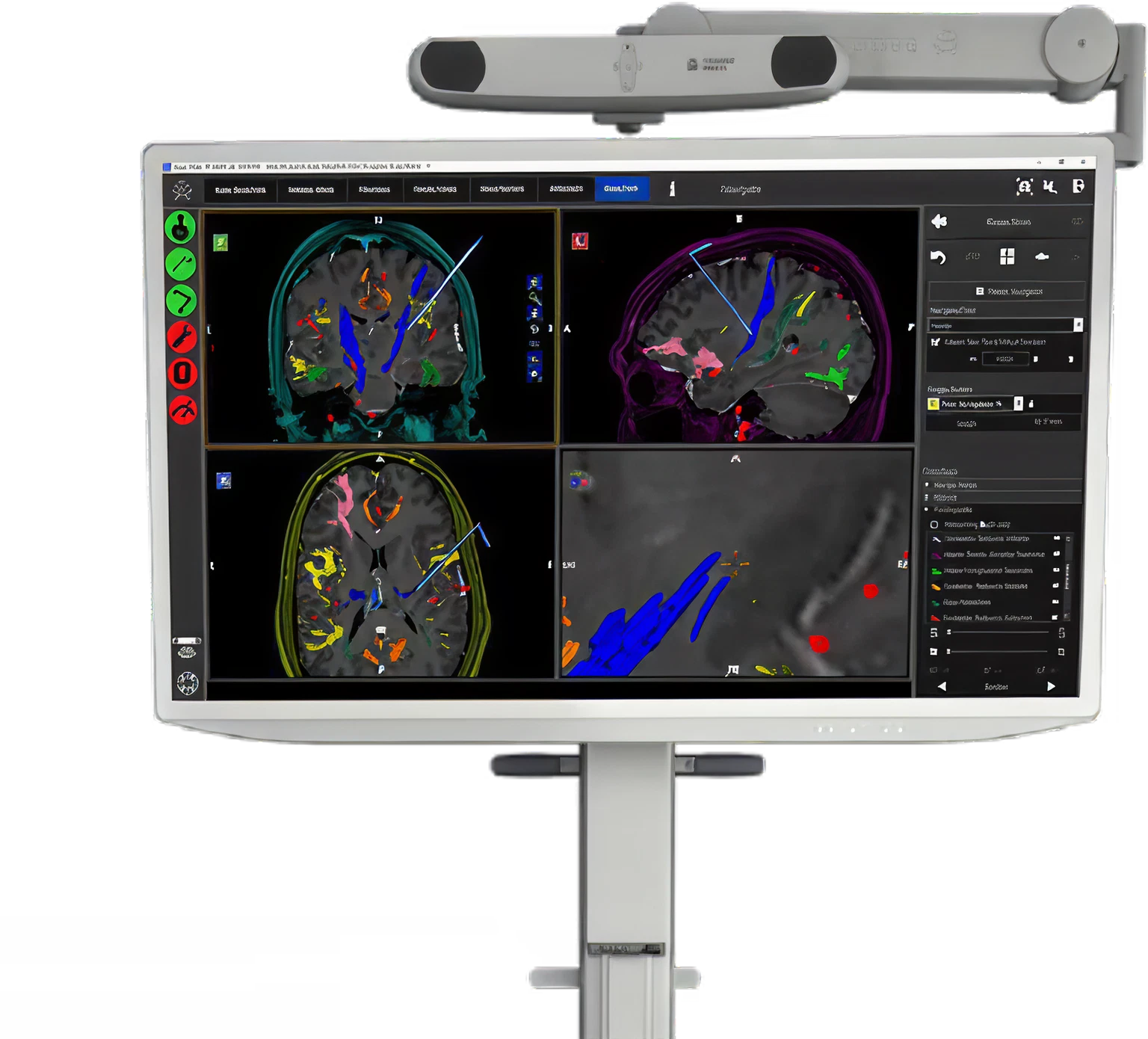 Medical monitor displaying brain scan images with colored annotations and analysis tools.