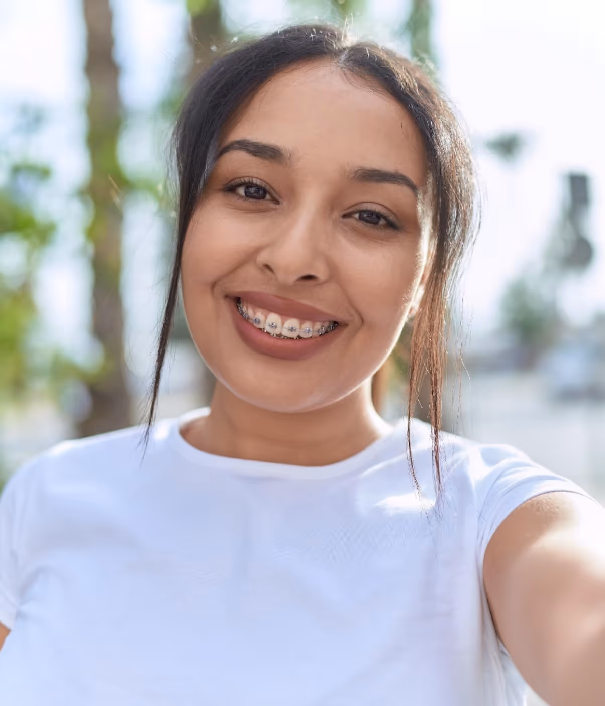 Smiling young woman with braces wearing a white t-shirt taking a selfie outdoors.