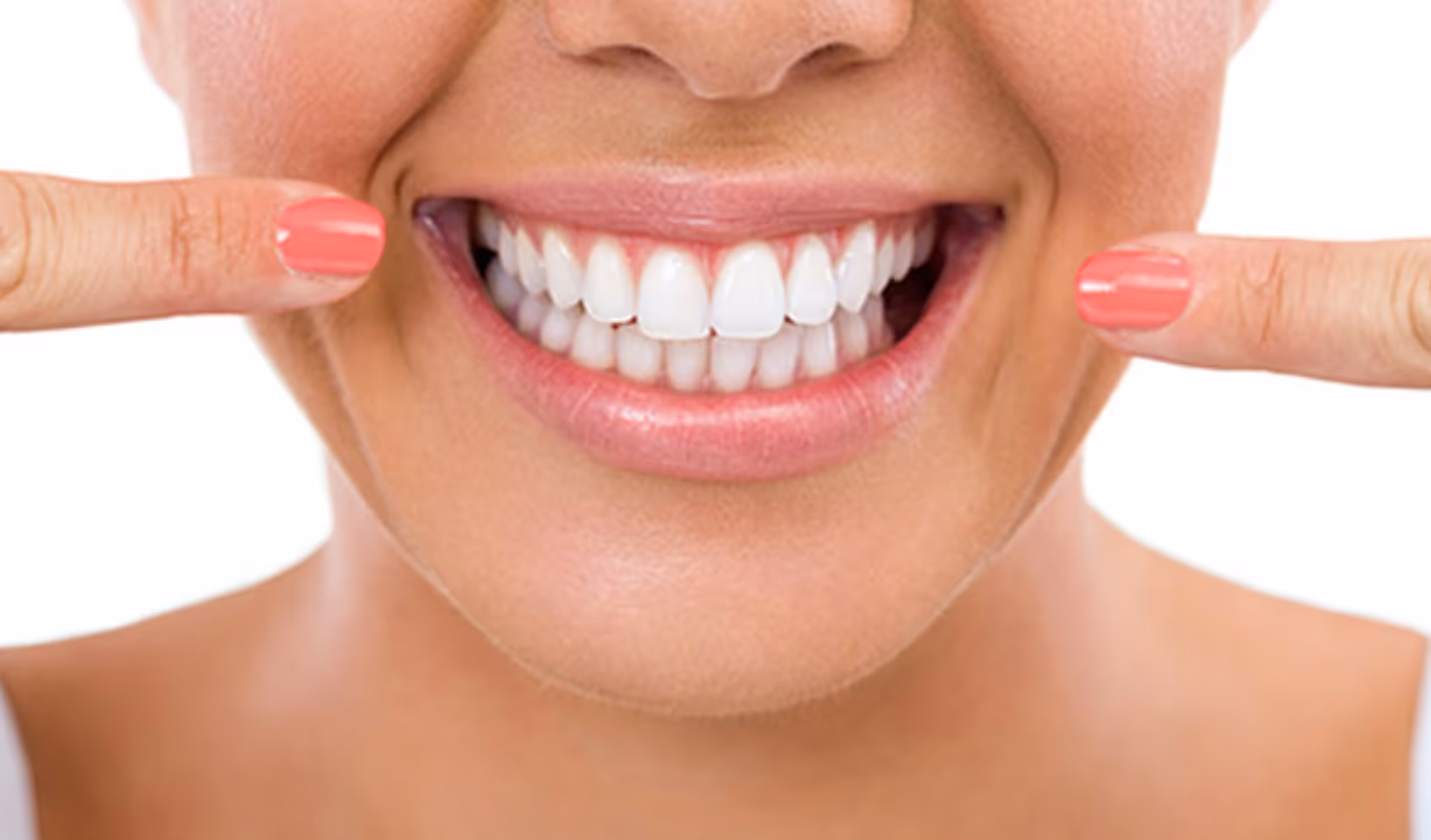 Close-up of a smiling person with white teeth pointing at their smile with both index fingers that have coral pink nail polish.