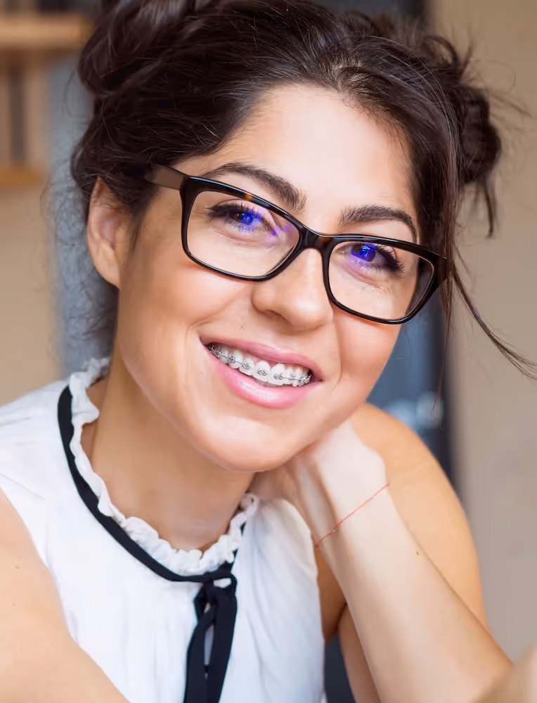 Smiling woman wearing glasses and braces, resting her head on her hand.