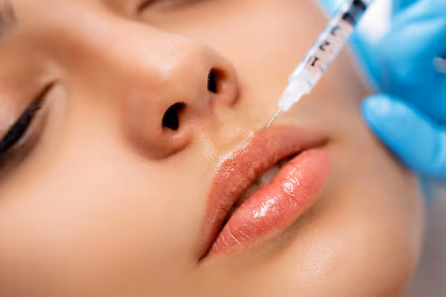 Ácido Hialurónico Facial