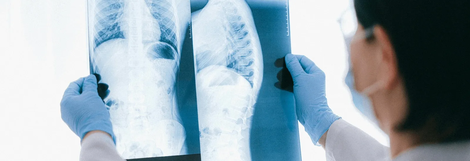 A doctor looks at a patient’s X-rays of the spine to determine the best solution for their spine condition in Los Angeles