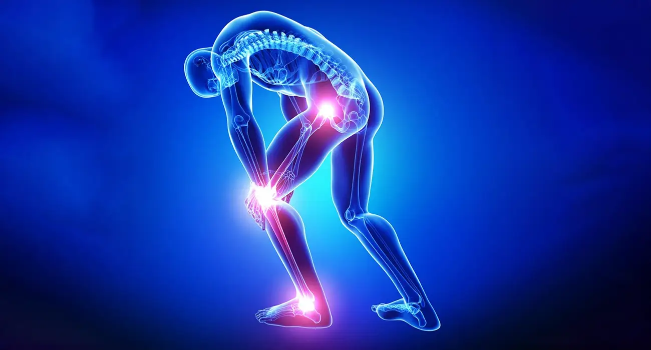 Medical illustration showing healthy joint cartilage compared with cartilage worn down over time